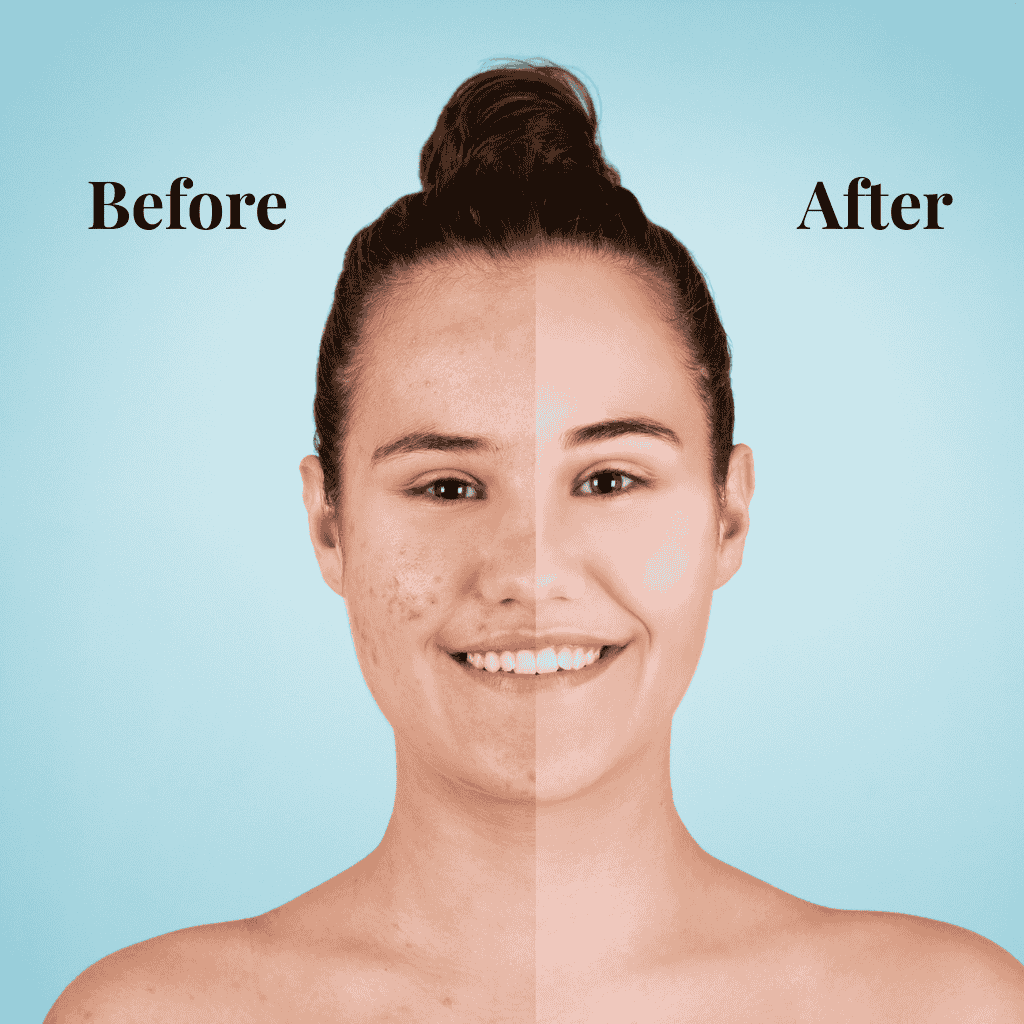 Professional Cosmetology Services - Hydra Facial, Acne Treatment, BB Glow Treatment in Satara.